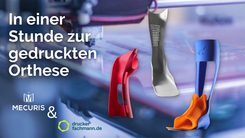 Webinar 3d-gedruckte Orthesen - In einer Stunde zur gedruckten Orthese